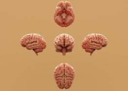 Various perspectives of a human brain are displayed.